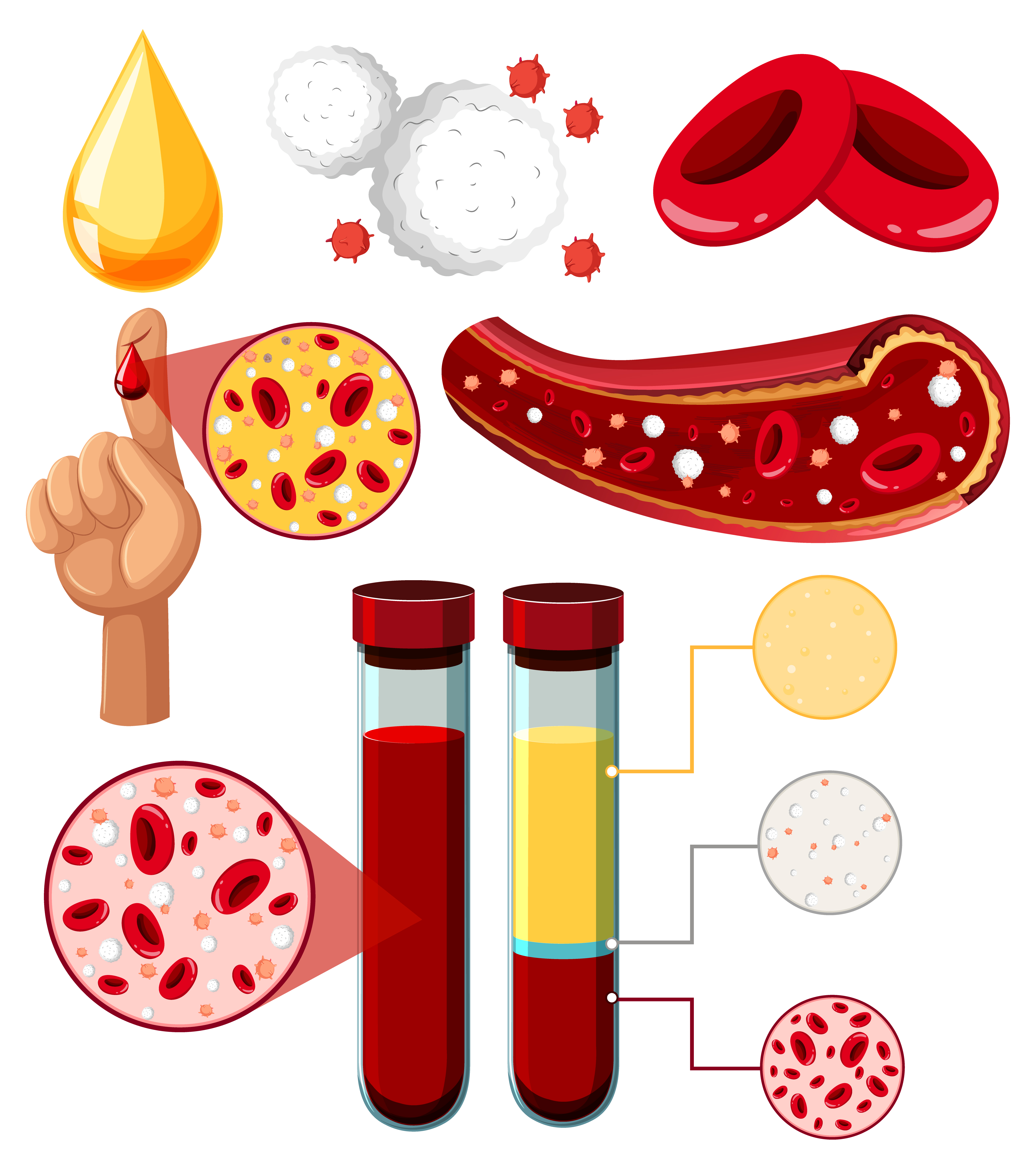 Labs